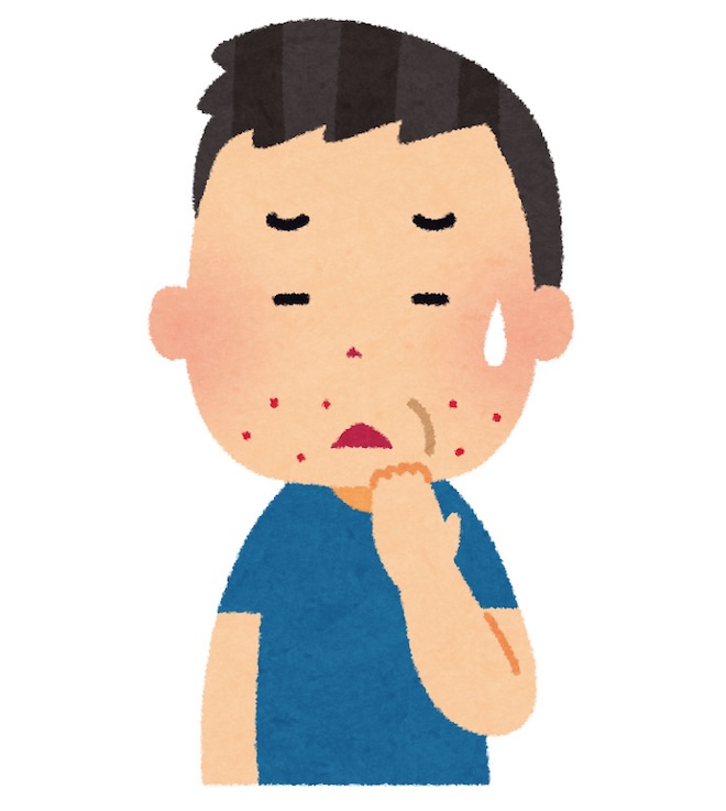 男性　髭剃り　肌荒れ